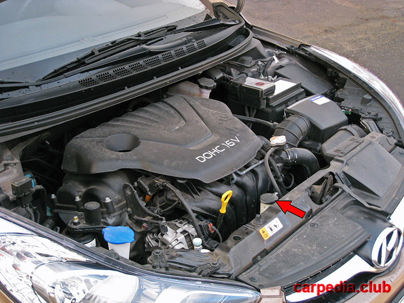 Расположение бачка охлаждающей жидкости на автомобиле Hyundai Elantra J5 MD